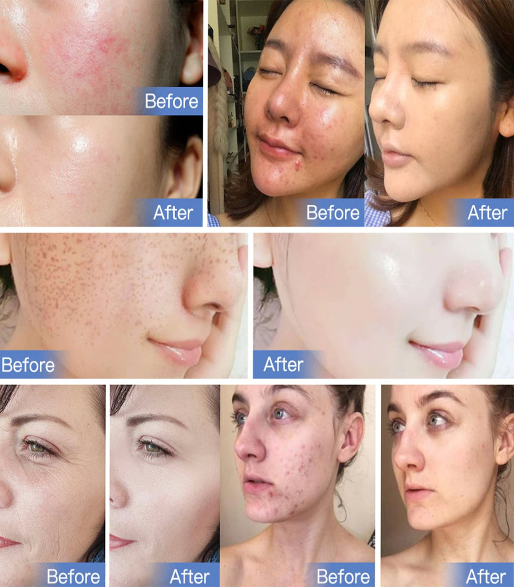 AstraGlow 7-Color LED Light Therapy Device for Radiant Skin - Desfino