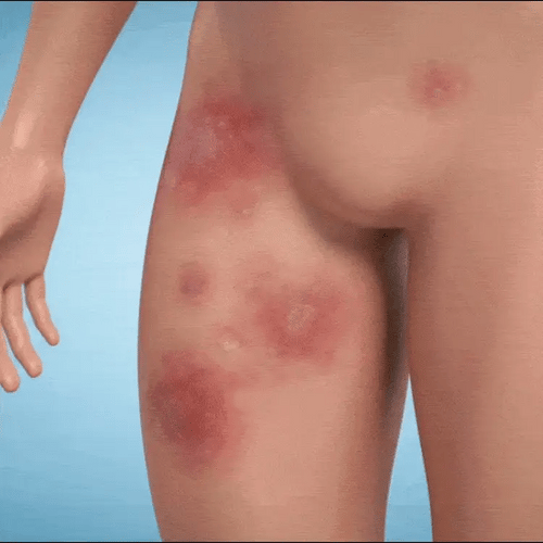 Pokročilé antifungální mýdlo narušující biofilm — hloubkové čištění | Desfino