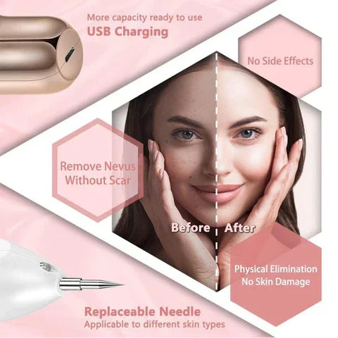 NovaDerm Skin Pen — justerbar plasmabehandling af pletter i 9 niveauer - Desfino
