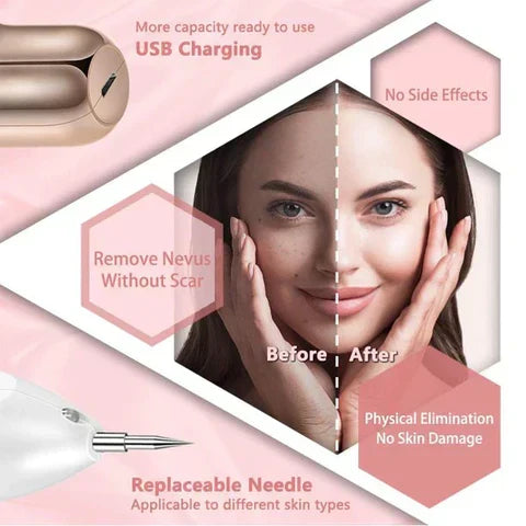 VeroPulse Skin Pen — 9 niveles de intensidad para eliminar acrocordones, lunares y verrugas - Desfino