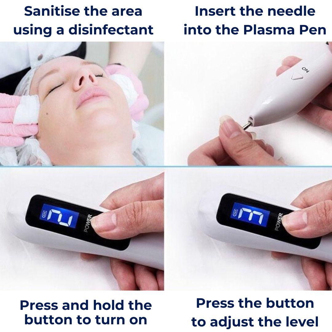 DermaLux Laser Plasma Pen — Skin Tag, Mole & Tattoo Removal Tool