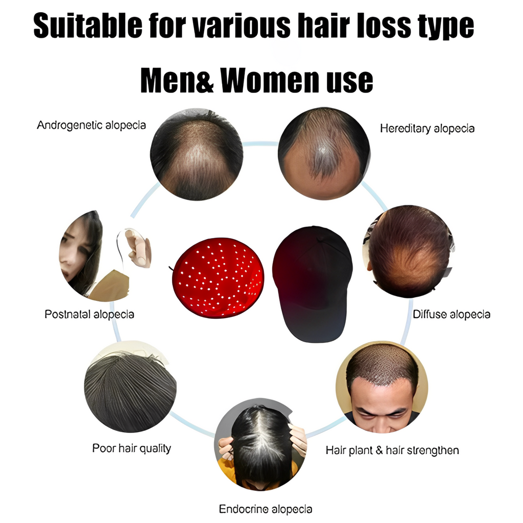 LumiCap Infrared Laser Cap — Non-Invasive Hair Growth Device | Desfino