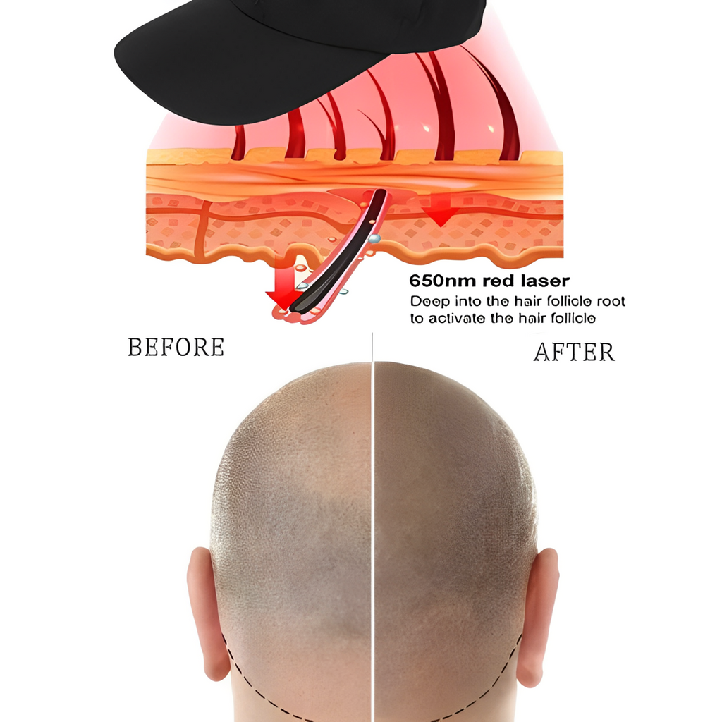 LumiCap Infrared Laser Cap — Non-Invasive Hair Growth Device | Desfino