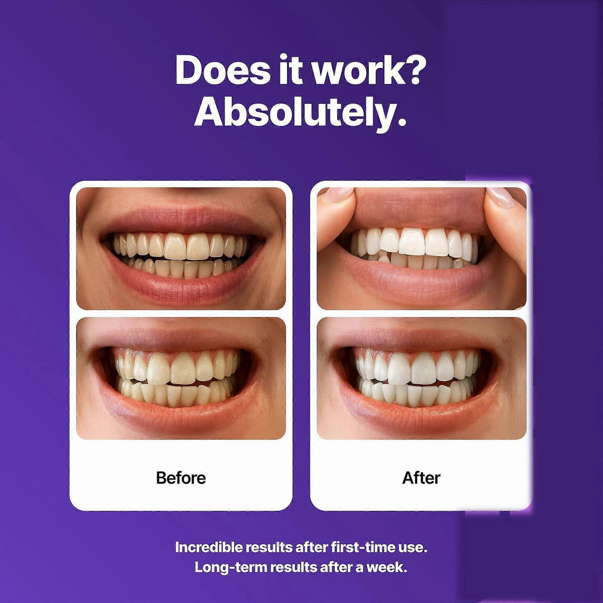 רצועות להלבנת שיניים SmileGuard PAP+ לשיניים רגישות - Desfino