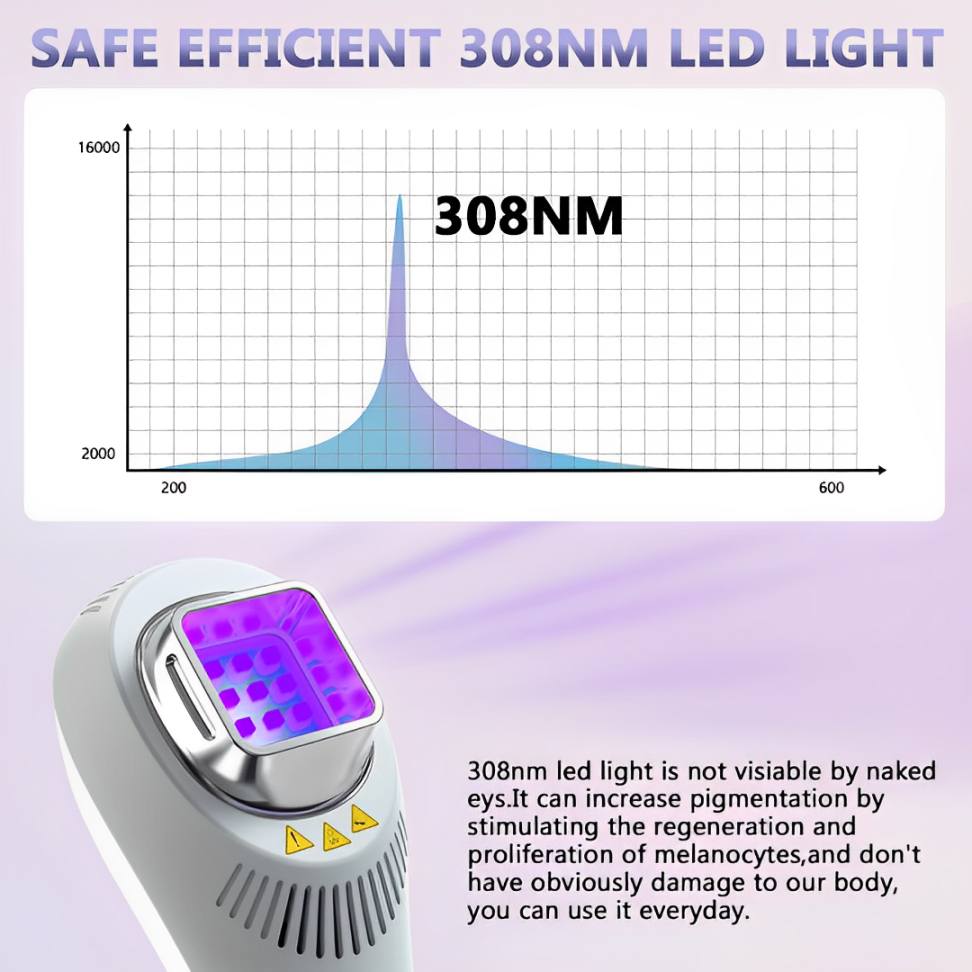 VitaLuma 308nm UVB Phototherapy Lamp — Portable Vitiligo Treatment - Desfino