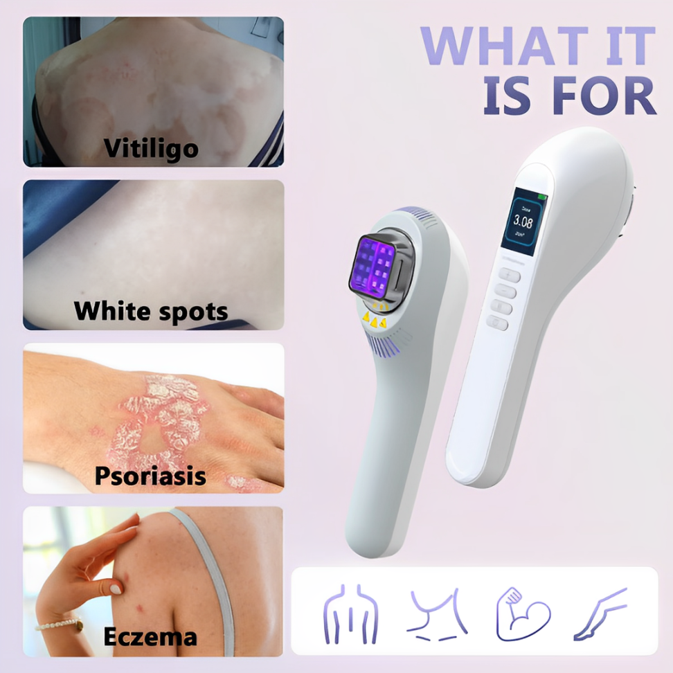 Tragbare 308nm-UVB-Therapielampe für Vitiligo, Psoriasis und Ekzeme - Desfino