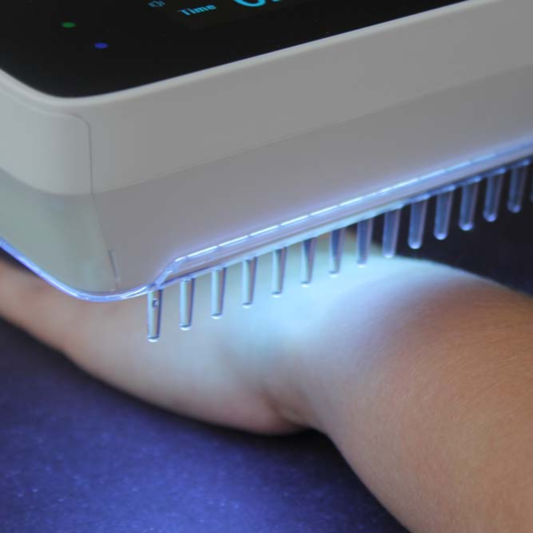LumaPulse håndholdt UVB-fototerapilampe — 2 Philips PL01-rør | Desfino