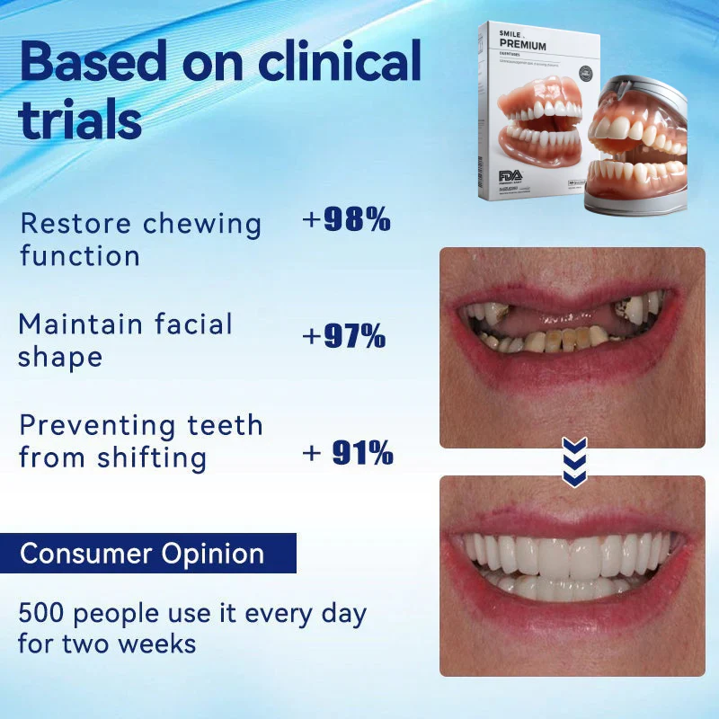Prótesis dentales completas personalizadas LumaDent — Marfil y blanco, ajuste personalizado - Desfino