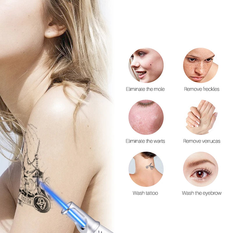 NovaDerm 皮秒激光笔 — 纹身、痣、雀斑和痤疮去除 - Desfino