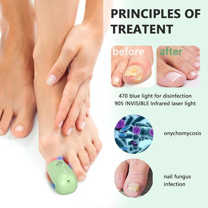 Dispositivo de terapia laser para unhas com três comprimentos de onda — 905nm, 660nm e 470nm - Desfino