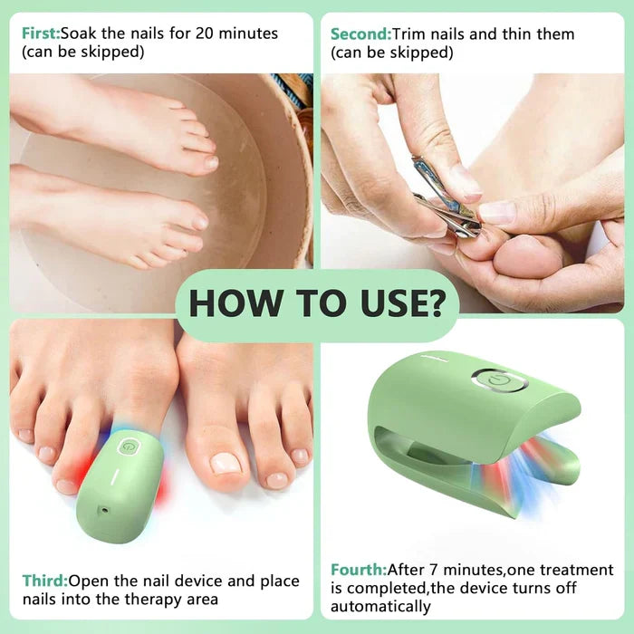 Dispositivo de terapia laser para unhas com três comprimentos de onda — 905nm, 660nm e 470nm - Desfino