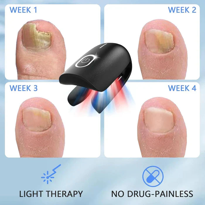 Dispositivo de terapia laser para unhas com três comprimentos de onda — 905nm, 660nm e 470nm - Desfino