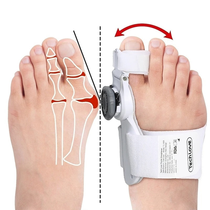 OrthoEase Adjustable Bunion Splint — Toe Corrector, Pain-Free - Desfino