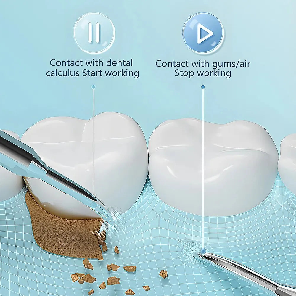 SonicDent 38 kHz Ultrasonic Teeth Cleaner — LED Light, USB Rechargeable - Desfino