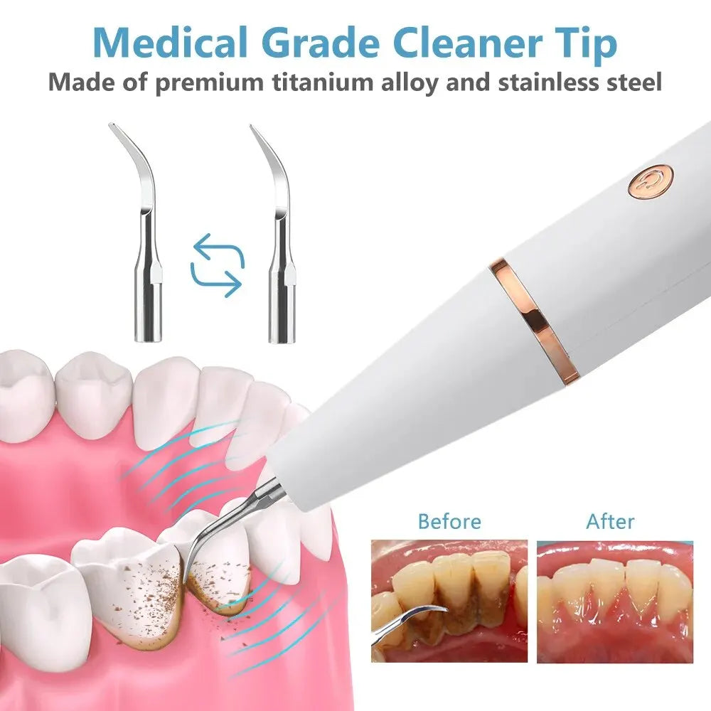 SonicDent 38 kHz Ultrasonic Teeth Cleaner — LED Light, USB Rechargeable - Desfino