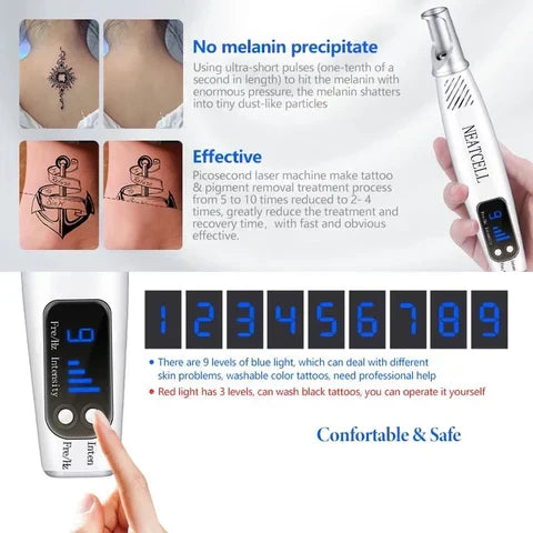 NovaDerm 皮秒激光笔 — 纹身、痣、雀斑和痤疮去除 - Desfino