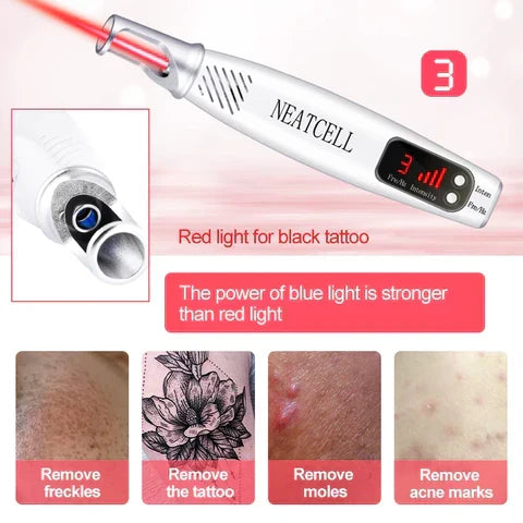 NovaDerm 皮秒激光笔 — 纹身、痣、雀斑和痤疮去除 - Desfino