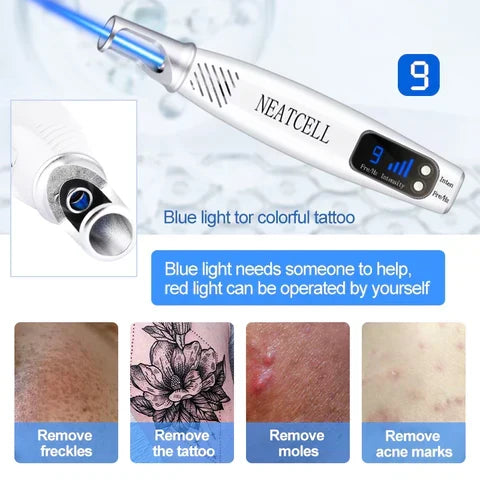 NovaDerm 皮秒激光笔 — 纹身、痣、雀斑和痤疮去除 - Desfino