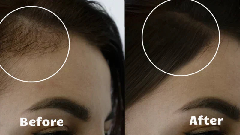 NovaWave Rotlicht-Haartherapie für dichteres, volleres Haar | Desfino