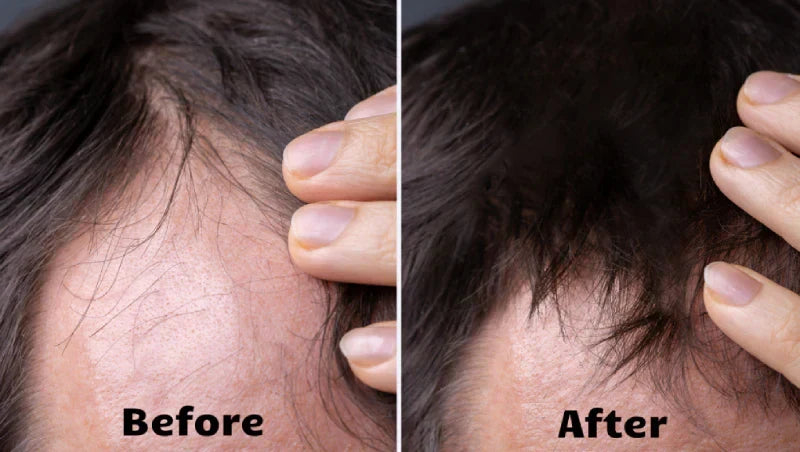 AstraGlow zařízení pro terapii vlasů červeným a modrým světlem — sérum, mikroproud - Desfino