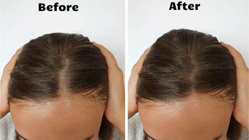 NovaWave Rotlicht-Haartherapie für dichteres, volleres Haar | Desfino