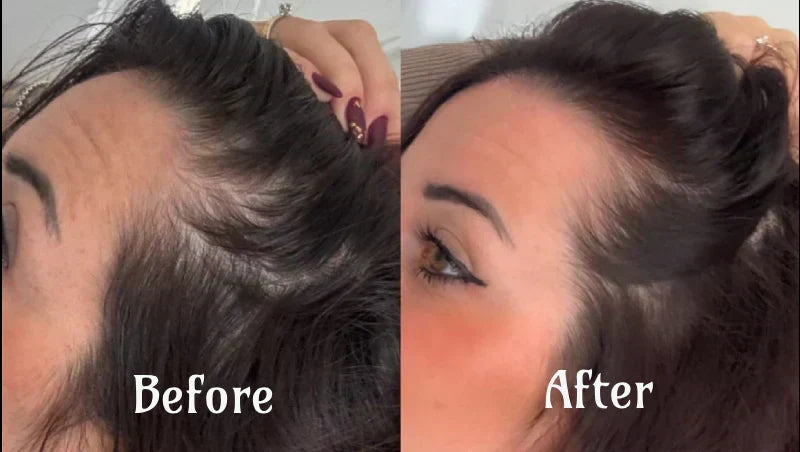 NovaWave Rotlicht-Haartherapie für dichteres, volleres Haar | Desfino