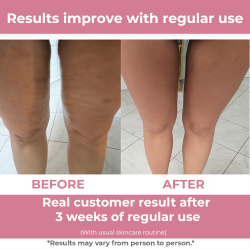 Rolo corporal FirmFlex Pro - massagem reafirmante da pele de tripla ação - Desfino