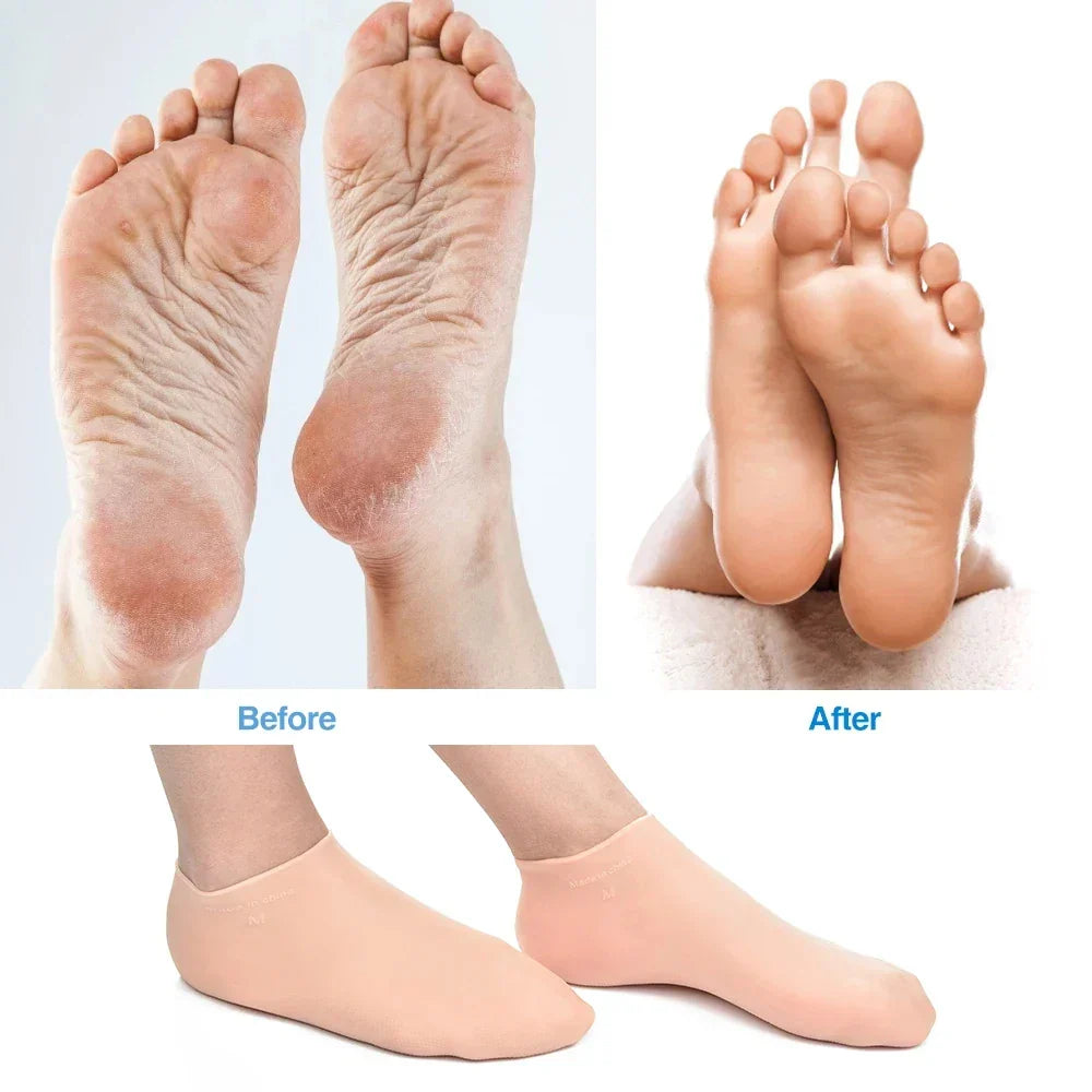Silicone Wetsuit Beach Socks