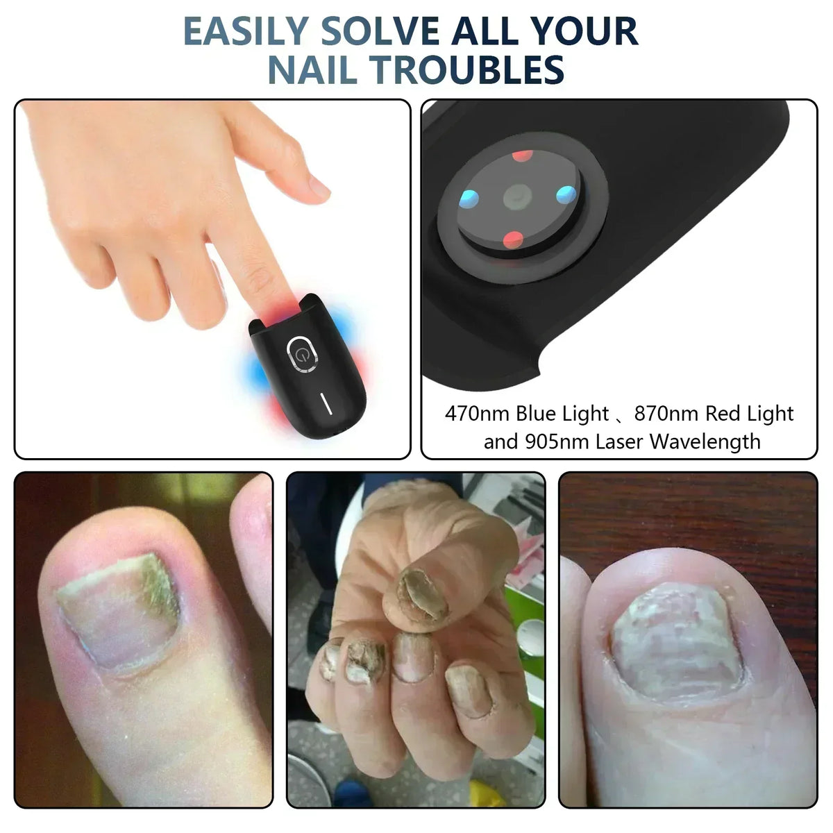 Dispositivo de terapia laser para unhas dos pés NovaNail com carregamento USB - Desfino