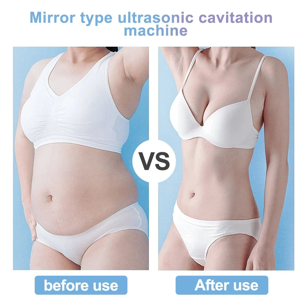 Body Contouring 4-in-1: cavitazione ultrasonica, RF, EMS e vuoto - Desfino