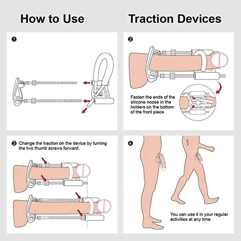 AxiomFlex Traction Device — Controlled Tension