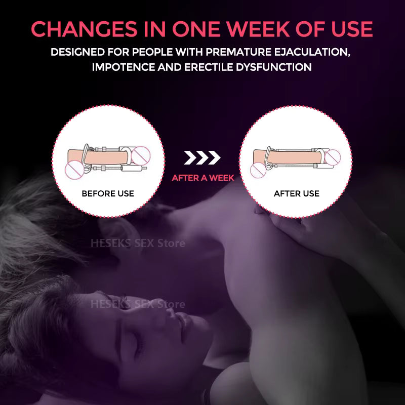 Quellix Adjustable Male Traction Device — One-Size Enhancement Aid - Desfino