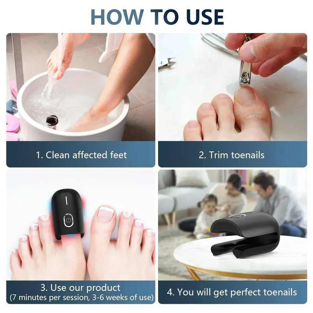 Dispositivo de terapia laser para unhas dos pés NovaNail com carregamento USB - Desfino