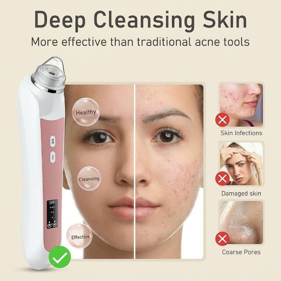 LuminaPore HD Pore Extractor — Real-Time Blackhead Removal | Desfino