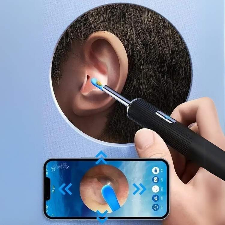 Kit de remoção de cera dos ouvidos Auracle Pro — Câmara HD de 1080p, LEDs - Desfino