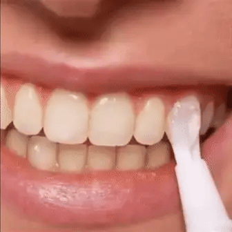 Swift Teeth Whitening Treatment — Quick Visible Stain Removal - Desfino