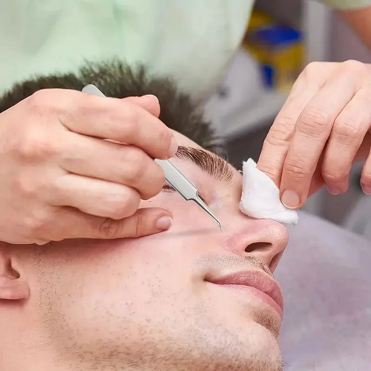 طقم أوريلا لإزالة الرؤوس السوداء وشعر الوجه — 3 قطع مع صندوق تخزين