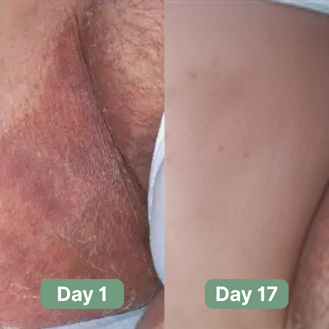 Sabão antifúngico avançado que desagrega biofilmes — Limpeza profunda | Desfino