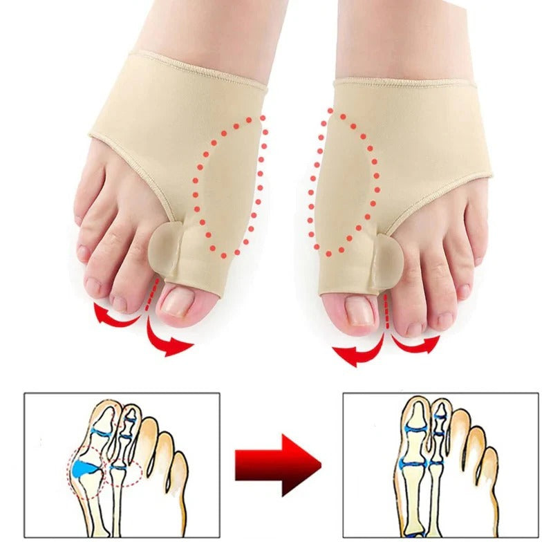 Toe Separator with Alignment Support