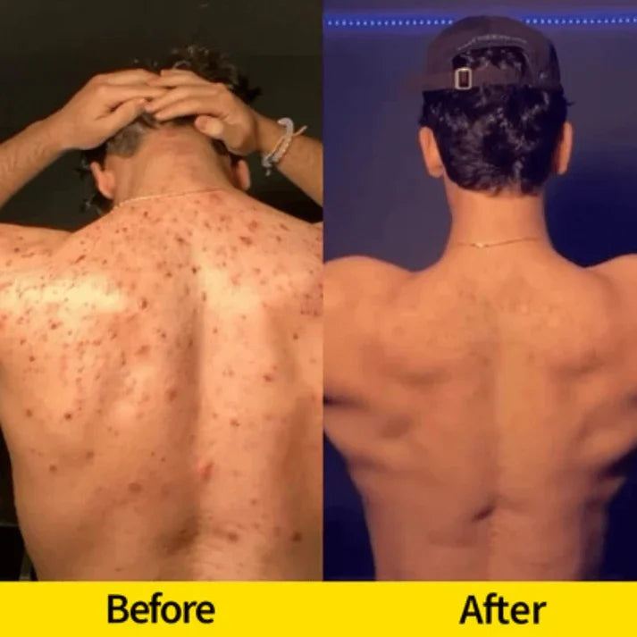 Kurkuma- és kojinsavas világosító tisztítószappan — arcra és testre - Desfino