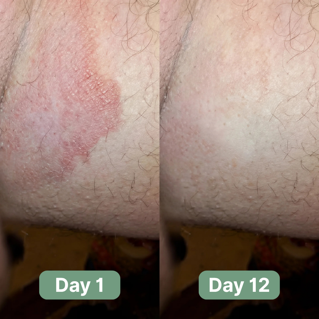 Sabão antifúngico avançado que desagrega biofilmes — Limpeza profunda | Desfino