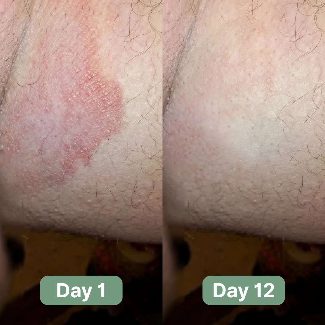 Sabão antifúngico avançado que desagrega biofilmes — Limpeza profunda | Desfino