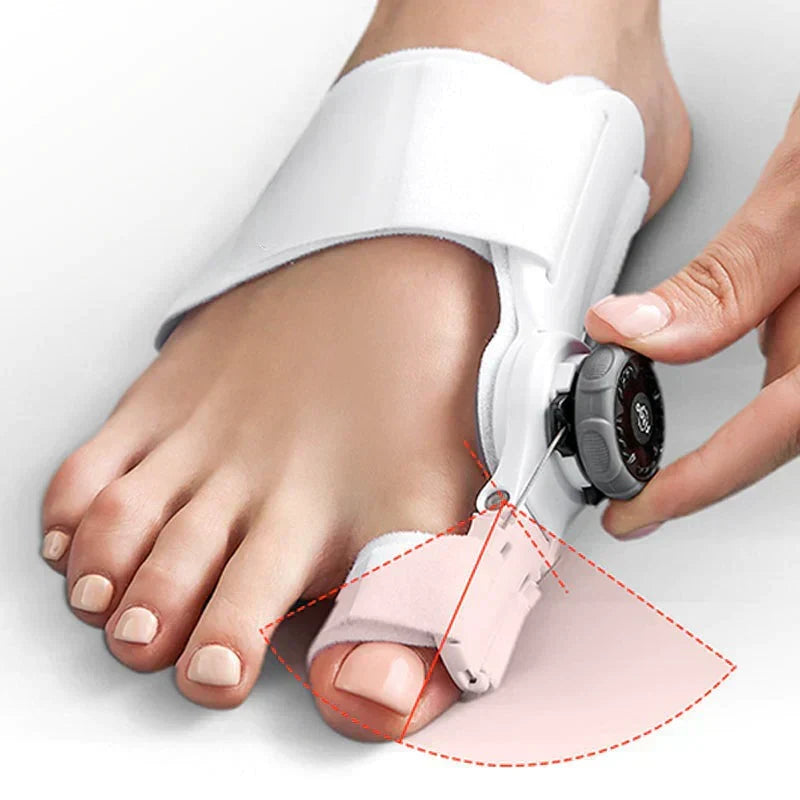 Nastavitelná korekční pomůcka na vbočený palec CalmStep — úleva díky správnému vyrovnání prstů - Desfino