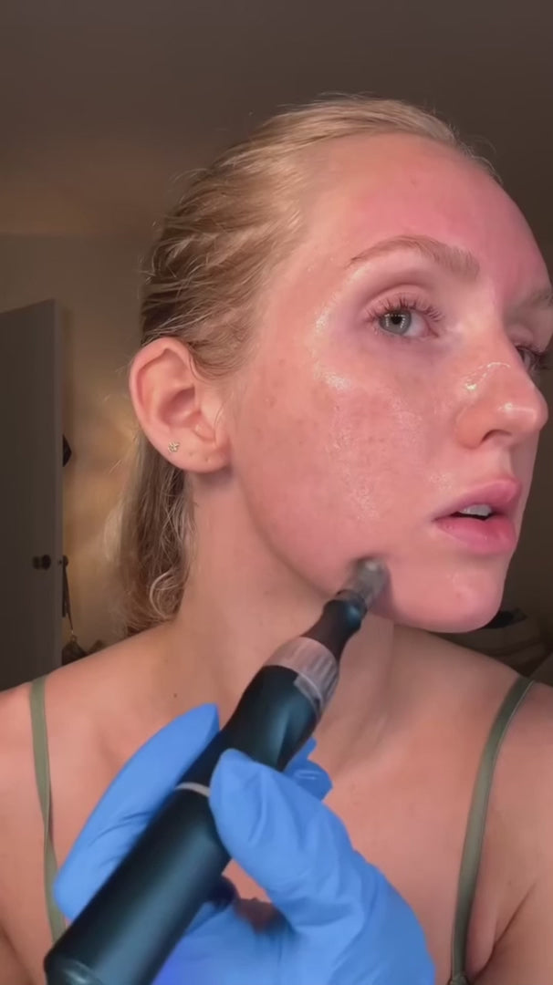 Lápiz recargable de microneedling — cartucho nanoespiral, renovación de la piel - Desfino