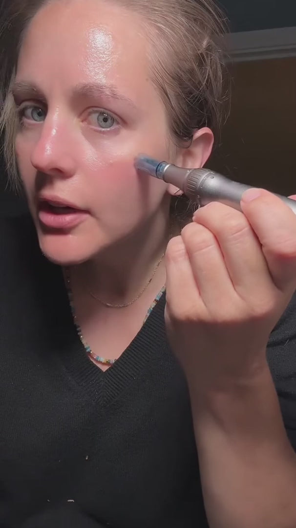 Lápiz recargable de microneedling — cartucho nanoespiral, renovación de la piel - Desfino