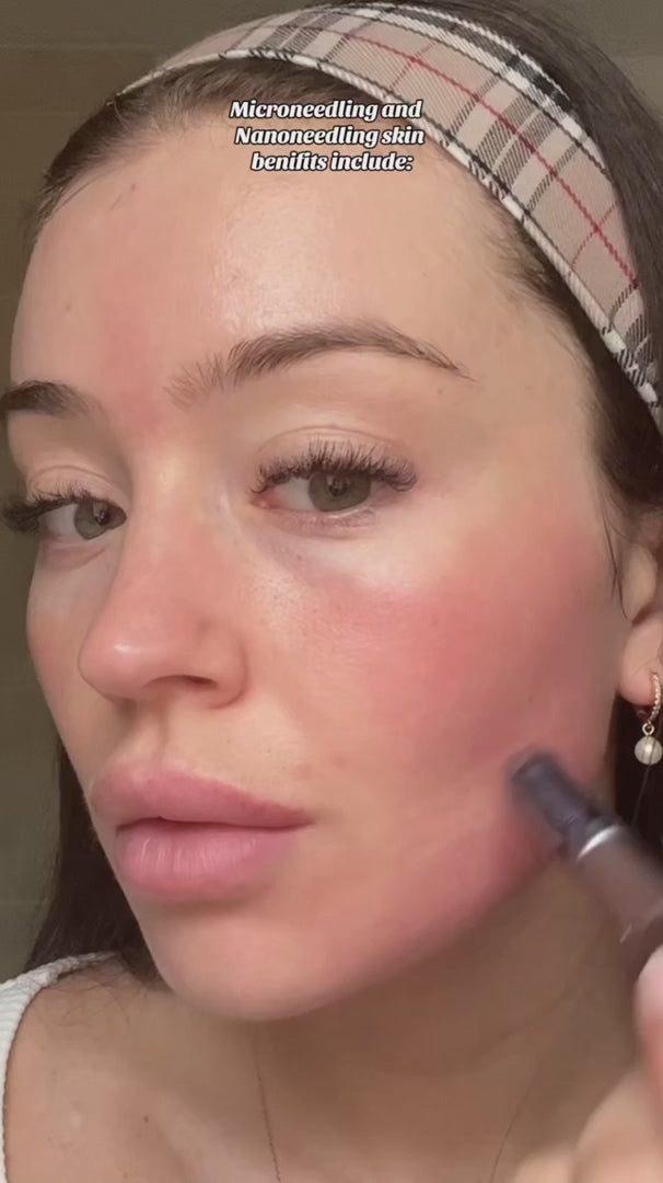 Lápiz recargable de microneedling — cartucho nanoespiral, renovación de la piel - Desfino