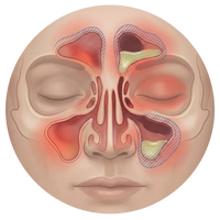 Nettoyeur nasal à double action — Rinçage salin et aspiration douce | Desfino