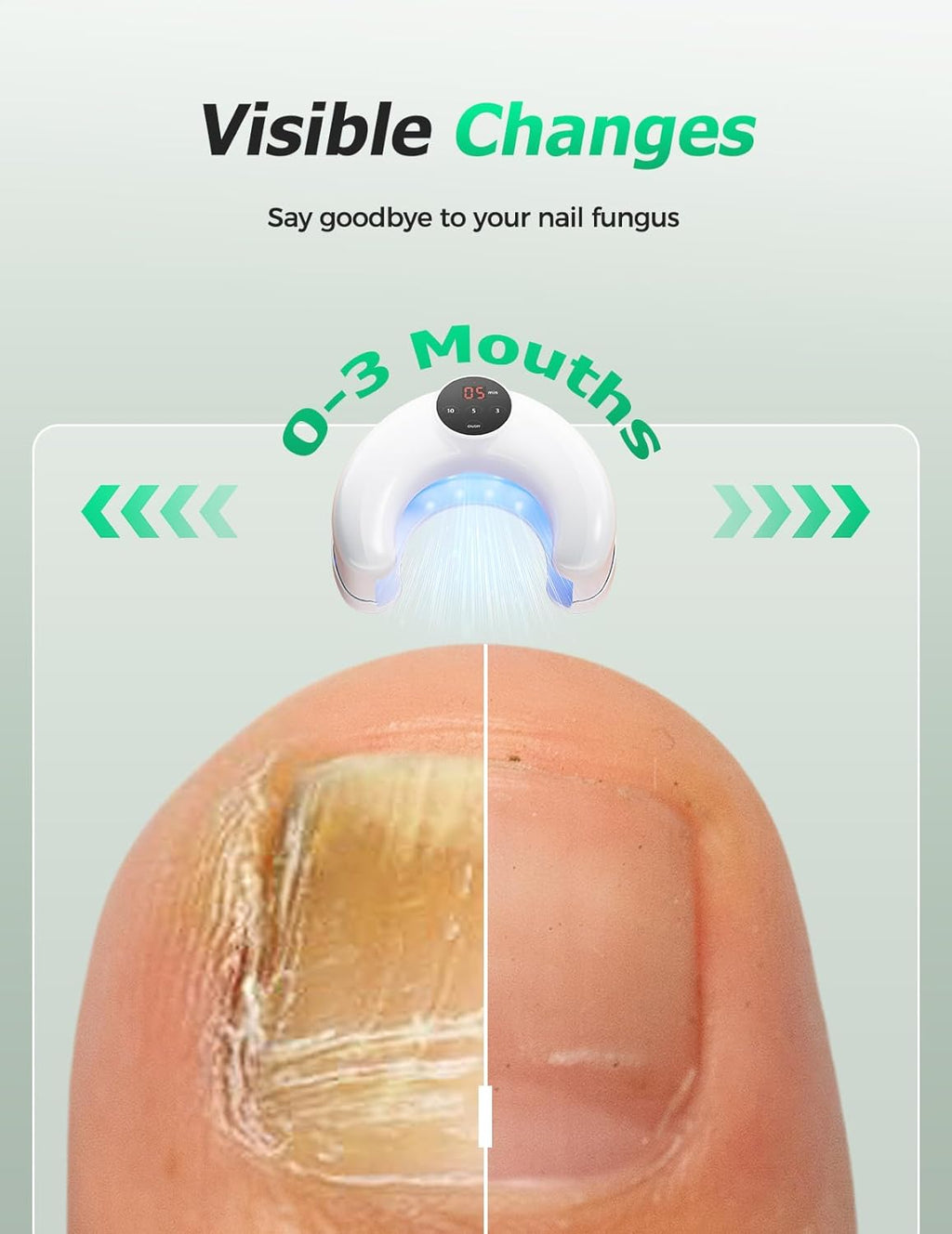 Appareil sans fil de thérapie à double lumière contre la décoloration des ongles - Desfino