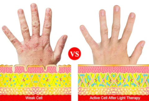 ArthroGlow-handskar för nära infraröd ljusterapi vid artrit — ergonomisk bärbar design, målinriktad ljusterapi